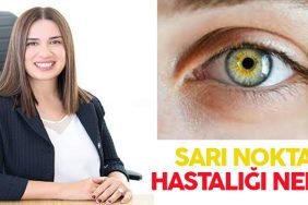SARI NOKTA HASTALIĞI NEDİR? 1 DDDDDDDDDDDD